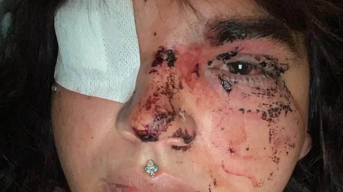 Brutal agresión tránsfoba a Bianca Lizbeth, Miss Trans Zamora: "Casi pierde la vida"