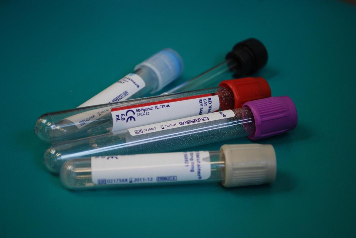 Acudir a hacerte un análisis de sangre