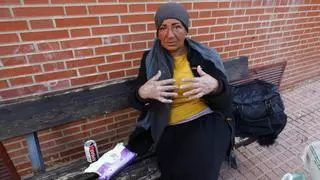 Abrasión a una indigente en Zaragoza: Rachina ya denunció en enero al mismo agresor por otras quemaduras con ácido