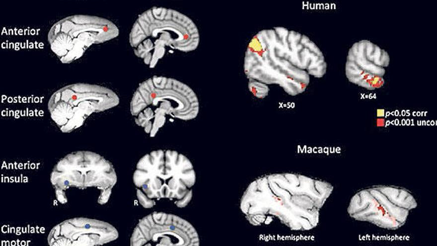 Escudriñando el cerebro