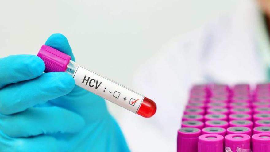 Spain is poised to be a leader in eliminating hepatitis C