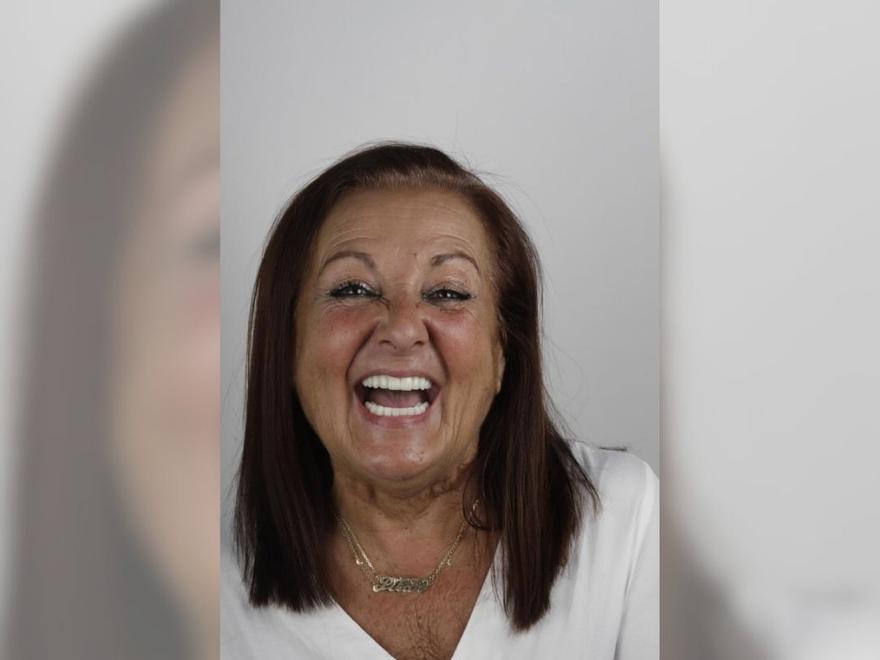 La operación dental que salvó la vida de la viguesa Pilar Domínguez: «Prefería morirme antes que verme así»