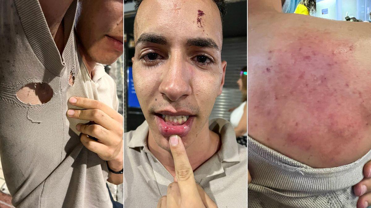 Houssam muestras las lesiones que presentaba tras ser reducido por la seguridad de la barraca Copity