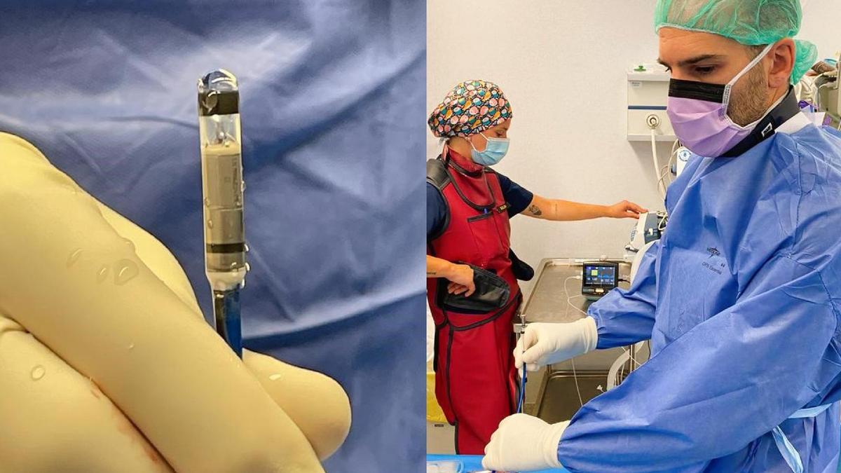 El doctor González durante la intervención para colocar el marcapasos más pequeño del mundo. A la izquierda, el dispositivo