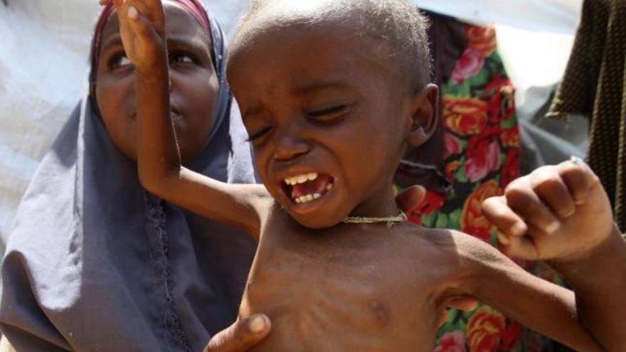 Una mujer sostiene a su hijo afectado de desnutrición en Mogadiscio (Somalia).