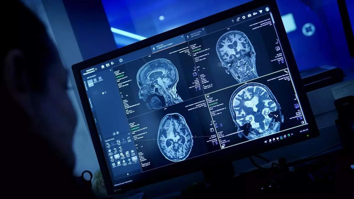 ¿Qué ocurre en tu cerebro cuando tu mente se queda en blanco?
