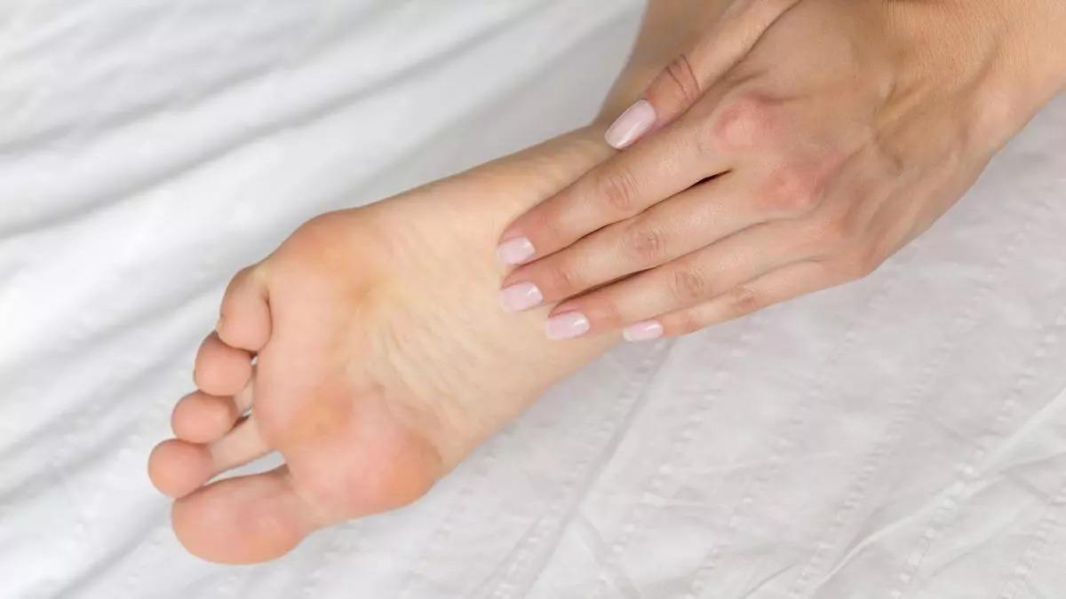 La primavera y el verano son un momento ideal para eliminar las verrugas.