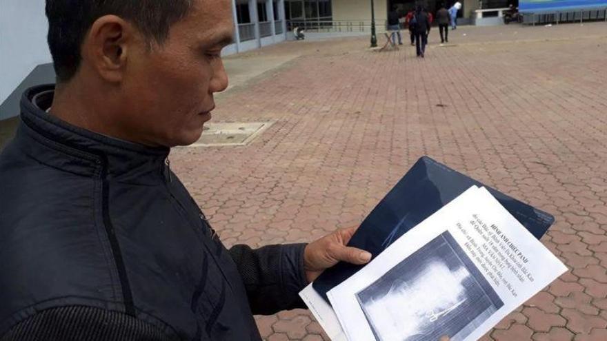 Un vietnamita vive con una tijeras en el estómago durante 18 años