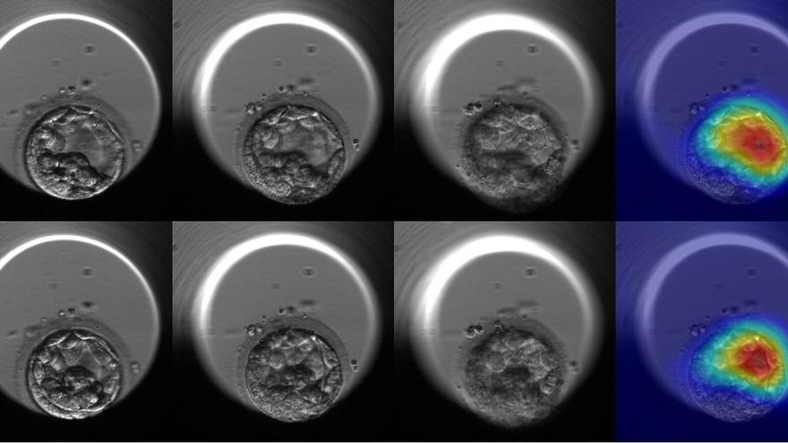 La Inteligencia Artificial ofrece una precisión del 75 % en la selección de embriones cromosómicamente normales