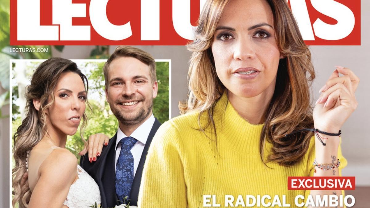 Paola Olmedo, tras su operación maxilofacial.