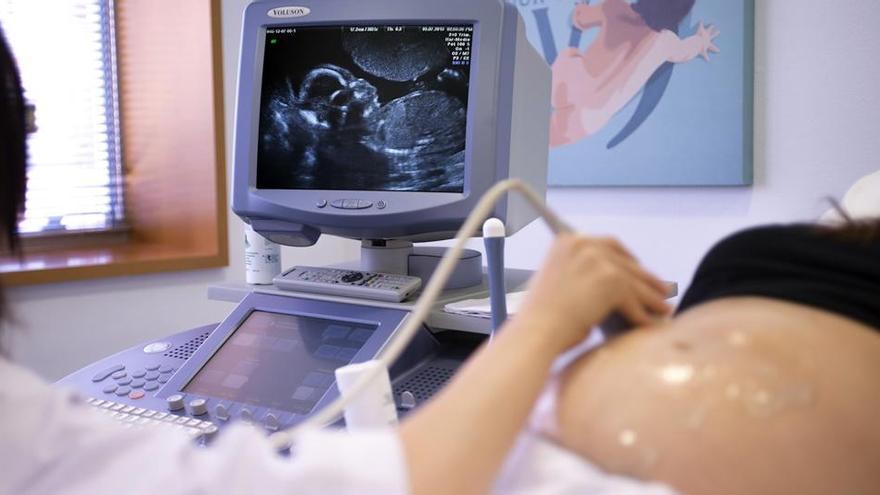 Wenn der Kinderwunsch in Erfüllung geht: eine Ultraschall-Untersuchung im IVI Mallorca.