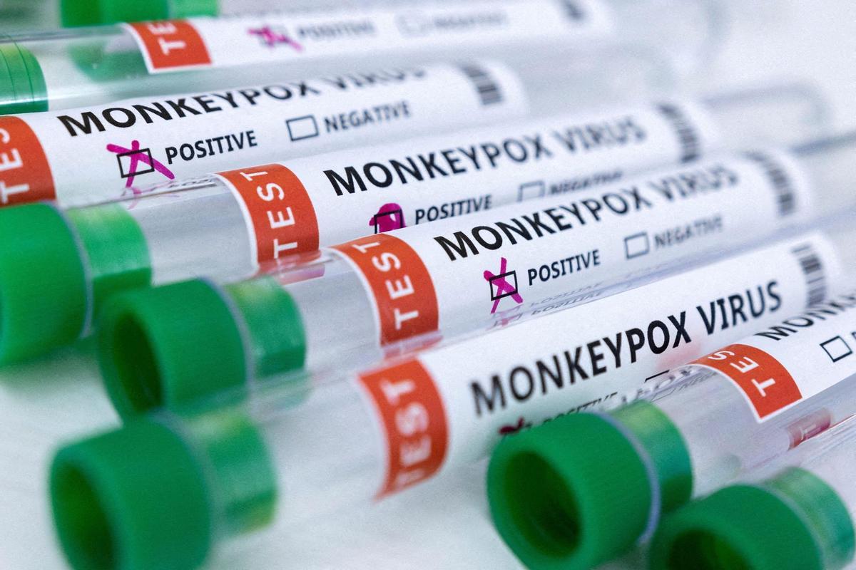 FILE PHOTO: Illustration shows test tubes labelled Monkeypox virus positive and negative\ FILE PHOTO: Illustration shows test tubes labelled Monkeypox virus positive and negative\