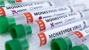 FILE PHOTO: Illustration shows test tubes labelled Monkeypox virus positive and negative\