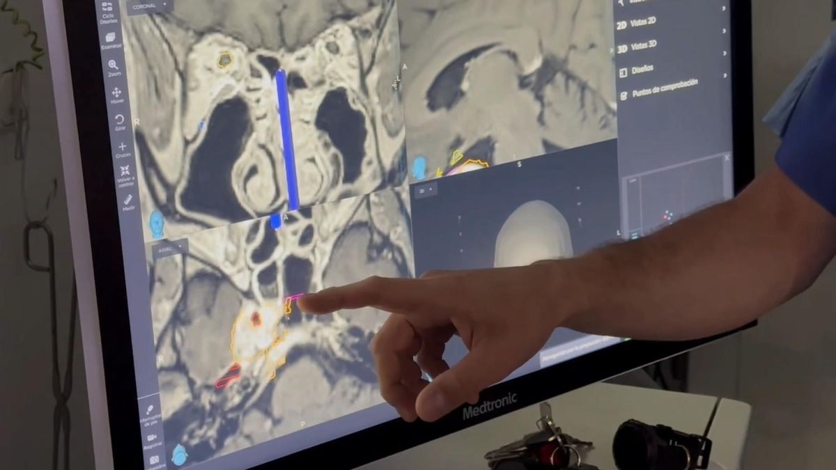 Juan Solivera, jefe de servicio de Neurolocirugía del hospital Reina Sofía