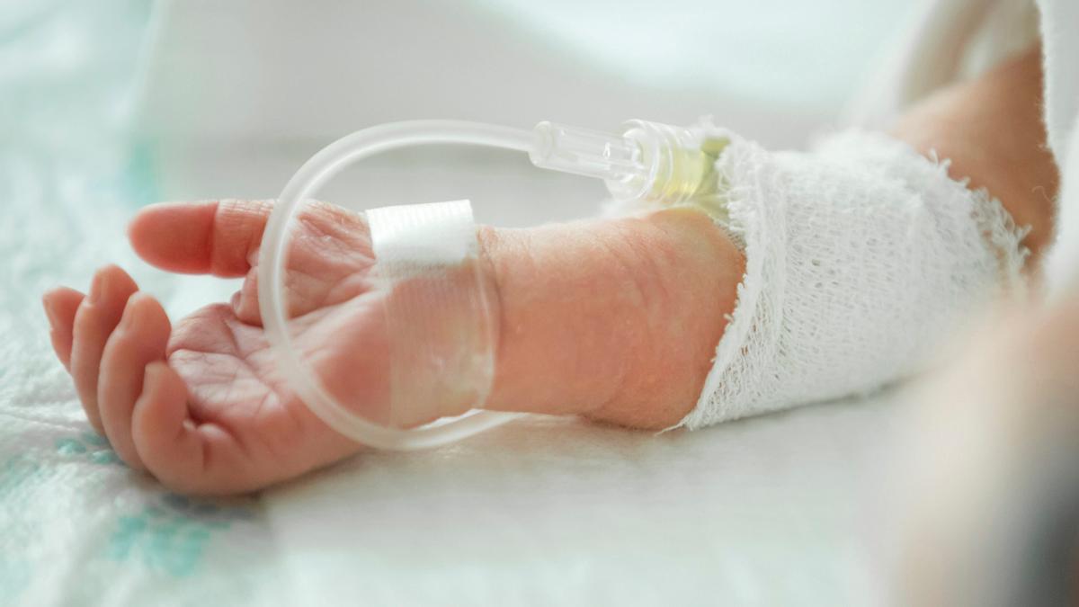 Un bebé recién nacido recibe alimentación intravenosa.