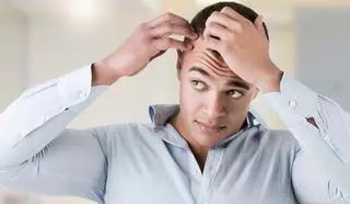 Cinco señales de que padeces alopecia y cómo remediarla
