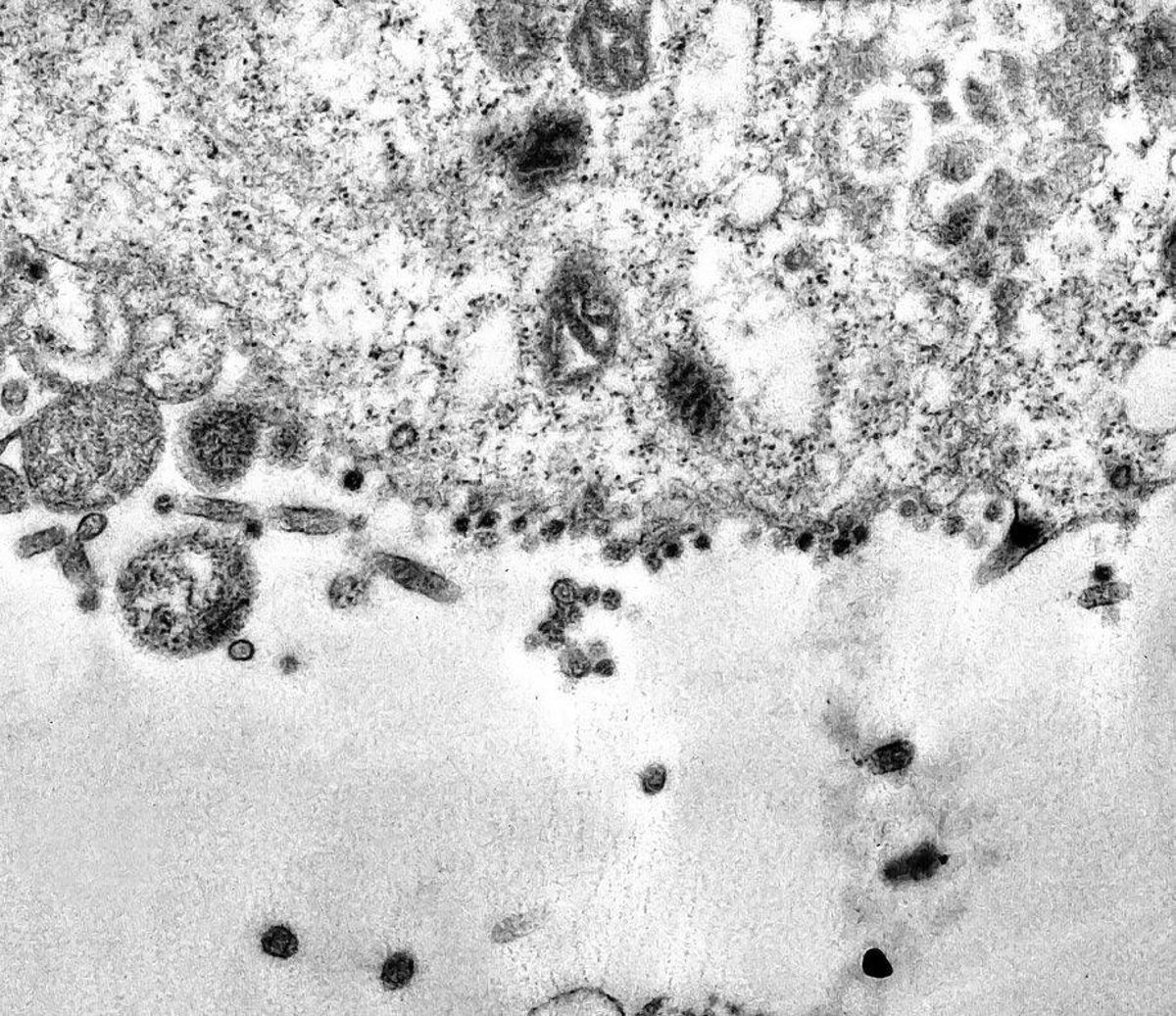 Río De Janeiro (Brazil), 08/04/2020.- A handout picture made available on 08 April 2020 by the Oswaldo Cruz Foundation shows a series of dark spots, which are viral particles of the SARS-COV-2 virus, trying to infect the cytoplasm of the cell, inside which is the nucleus, responsible for storing the genetic material of the cell. Brazilian scientists have captured images of the exact moment when the SARS-COV-2 virus infects a cell, the Oswaldo Cruz Foundation (Fiocruz) of Rio de Janeiro, Brazil, the largest medical research center in Latin America, reported on 08 April 2020. The photographs were taken with a transmission electron microscope during a study on the viral replication of SARS-CoV-2 and show in detail the contamination process of a cell, according to a statement from Fiocruz. (Brasil) EFE/EPA/Débora Barreto / FIOCRUZ HANDOUT HANDOUT EDITORIAL USE ONLY/NO SALES/NO ARCHIVES Río De Janeiro (Brazil), 08/04/2020.- A handout picture made available on 08 April 2020 by the Oswaldo Cruz Foundation shows a series of dark spots, which are viral particles of the SARS-COV-2 virus, trying to infect the cytoplasm of the cell, inside which is the nucleus, responsible for storing the genetic material of the cell. Brazilian scientists have captured images of the exact moment when the SARS-COV-2 virus infects a cell, the Oswaldo Cruz Foundation (Fiocruz) of Rio de Janeiro, Brazil, the largest medical research center in Latin America, reported on 08 April 2020. The photographs were taken with a transmission electron microscope during a study on the viral replication of SARS-CoV-2 and show in detail the contamination process of a cell, according to a statement from Fiocruz. (Brasil) EFE/EPA/Débora Barreto / FIOCRUZ HANDOUT HANDOUT EDITORIAL USE ONLY/NO SALES/NO ARCHIVES