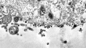 Río De Janeiro (Brazil), 08/04/2020.- A handout picture made available on 08 April 2020 by the Oswaldo Cruz Foundation shows a series of dark spots, which are viral particles of the SARS-COV-2 virus, trying to infect the cytoplasm of the cell, inside which is the nucleus, responsible for storing the genetic material of the cell. Brazilian scientists have captured images of the exact moment when the SARS-COV-2 virus infects a cell, the Oswaldo Cruz Foundation (Fiocruz) of Rio de Janeiro, Brazil, the largest medical research center in Latin America, reported on 08 April 2020. The photographs were taken with a transmission electron microscope during a study on the viral replication of SARS-CoV-2 and show in detail the contamination process of a cell, according to a statement from Fiocruz. (Brasil) EFE/EPA/Débora Barreto / FIOCRUZ HANDOUT HANDOUT EDITORIAL USE ONLY/NO SALES/NO ARCHIVES