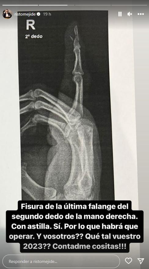 Risto Mejide comunica que tendrá que pasar por quirófano tras su accidente