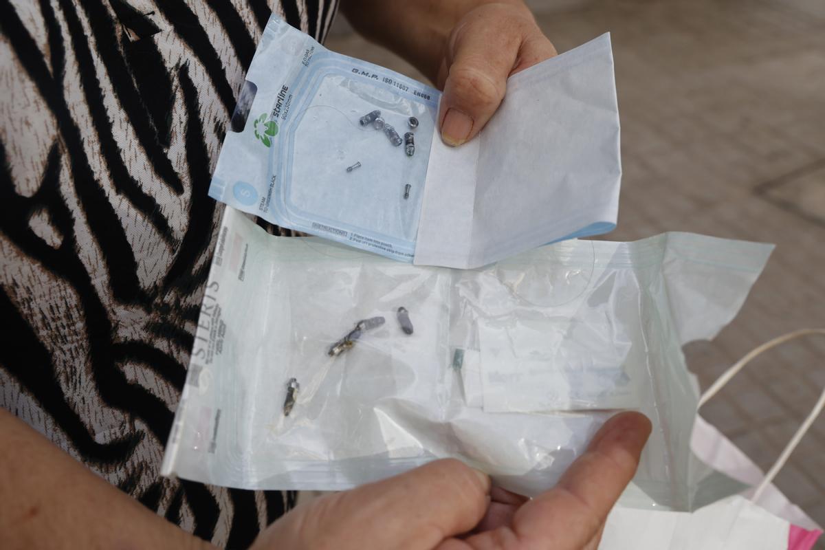 Rosa muestar los tornillos que le han extraído en Implant Clinics