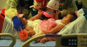 Jimena i Scarlet descansen després de ser operades a l’hospital infantil de Driscoll, a Texas (EUA).