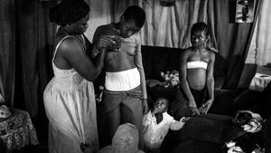 Una de las fotografías de ’Belleza prohibida’, que documentan como en Camerún las madres planchan el pecho de sus hijas para evitar su violación.