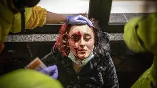 La joven que perdió un ojo por un disparo de foam de los Mossos pide reabrir el caso