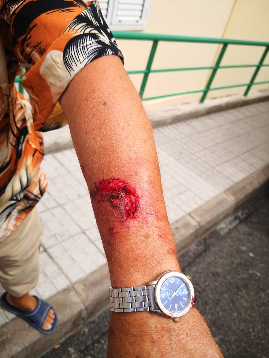Un perro ataca a un hombre en Las Palmas de Gran Canaria