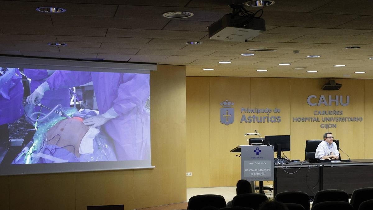El Hospital de Cabueñes se forma en cirugía mínimamente invasiva de pared abdominal con Javier López Monclús