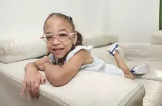 Briana Trujillo, la pequeña canaria con una enfermedad rara en la piel
