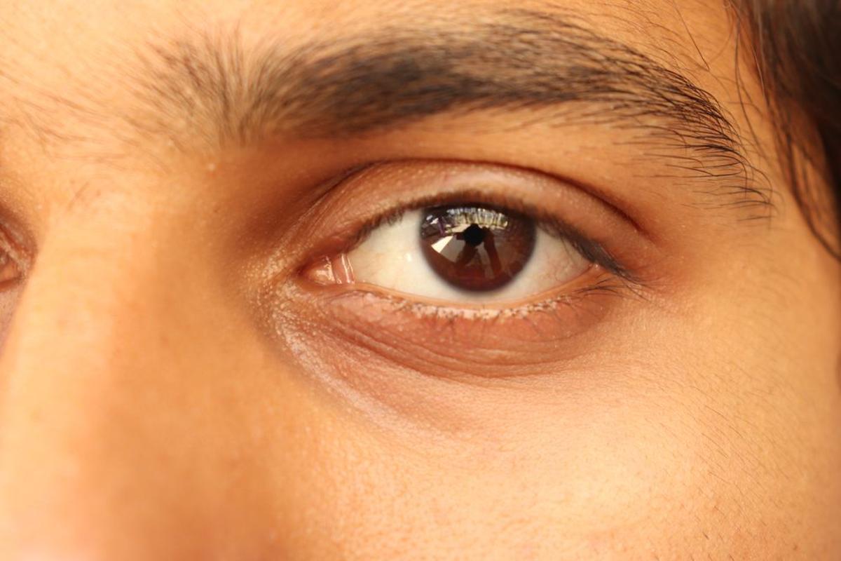 Estos son los culpables de que tengas ojeras y así puedes prevenirlas.