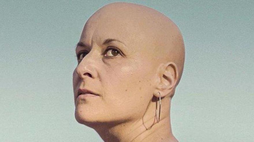 El documental ‘Mujeres calvas’, de Sandra Román, llega a Multicines Tenerife