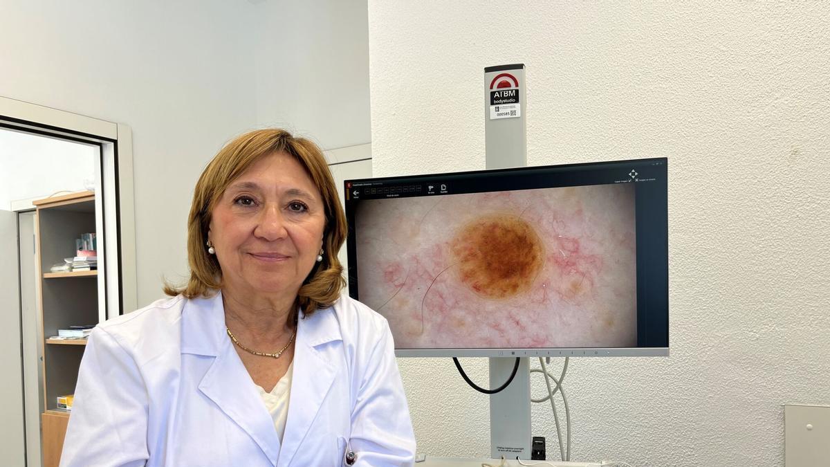 La dermatóloga Dolores Sánchez-Aguilar, delante de una pantalla en la que puede verse un melanoma.