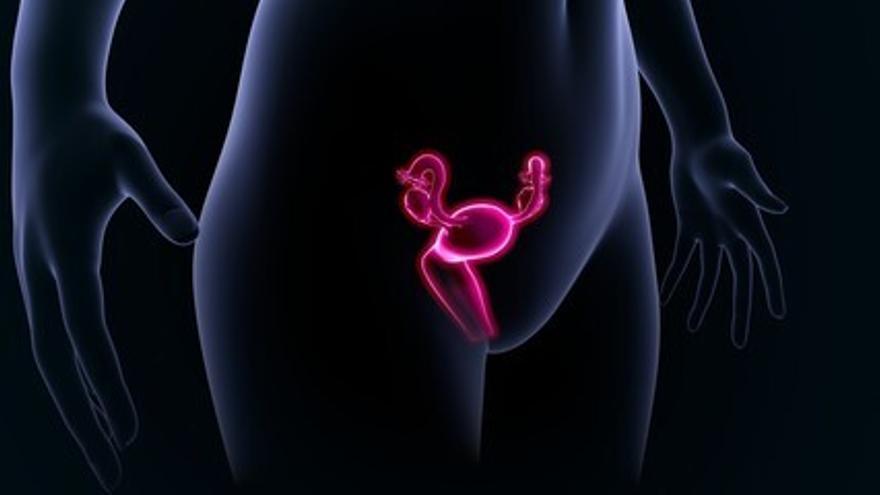 Existen distintos tipos de miomas uterinos según su ubicación.
