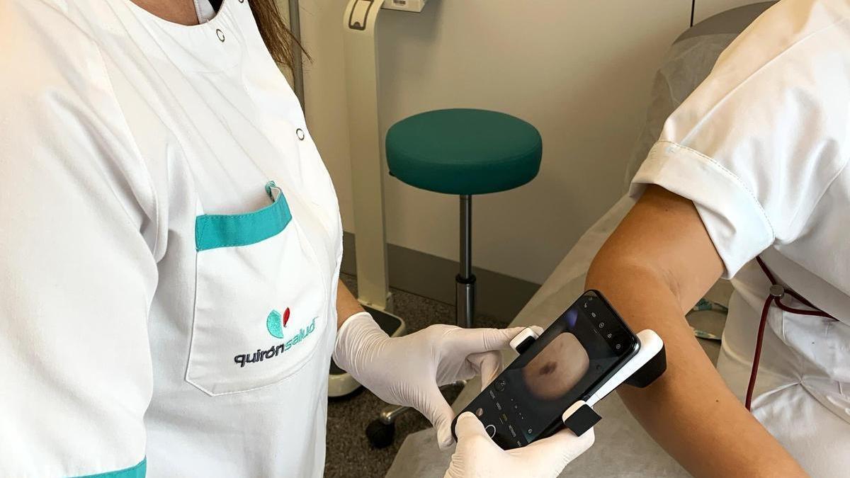 Del dermatoscópio es una técnica médica no invasiva que combina la exploración de la piel con un microscopio de alta resolución y un sistema fotográfico. Permite crear un mapa digital de los lunares para detectarlos tempranamente.