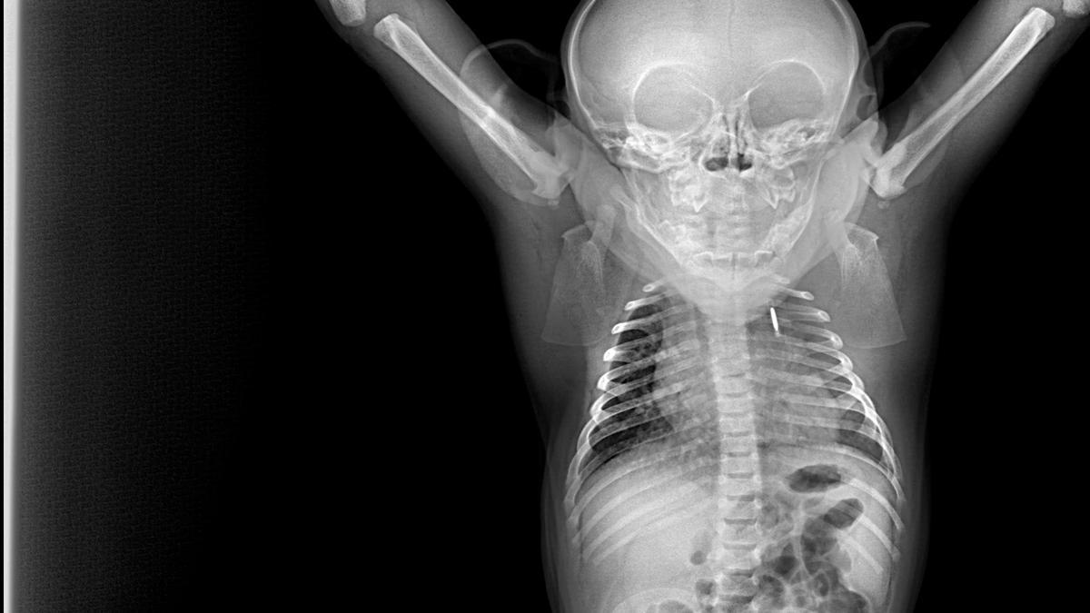 Las radiografías más terroríficas del Bioparc Fuengirola