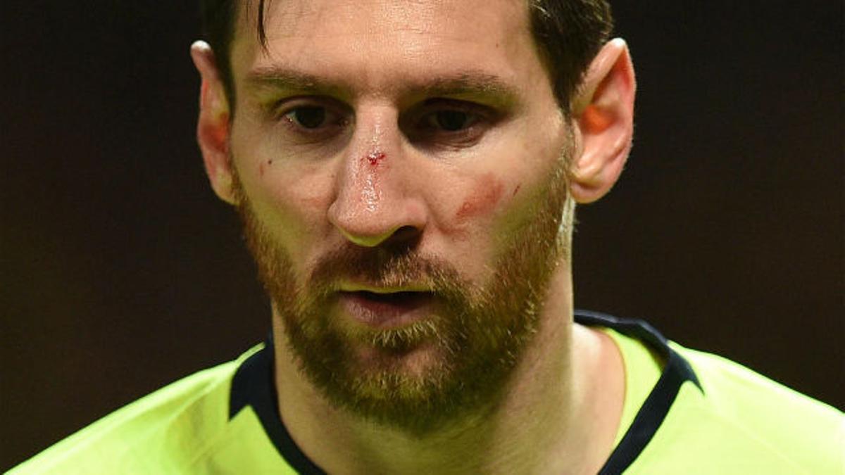 La escalofriante imagen de Messi sangrando por la nariz