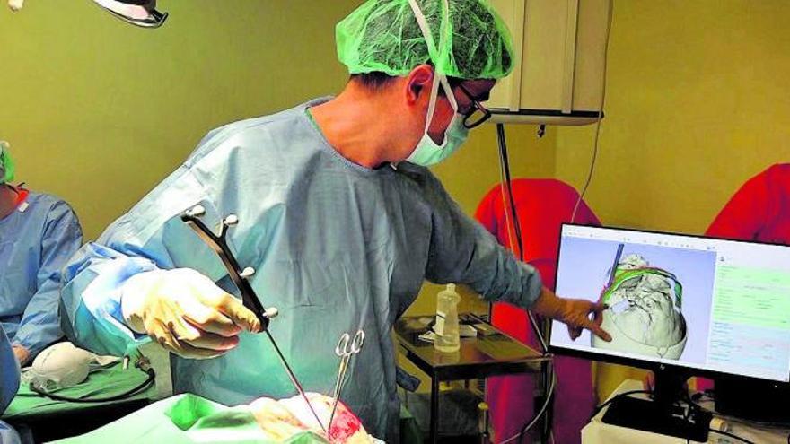 Un cirurgià opera un nadó amb la tècnica innovadora a l’hospital Gregorio Marañón de Madrid. | HOSPITAL GREGORIO MARAÑÓN