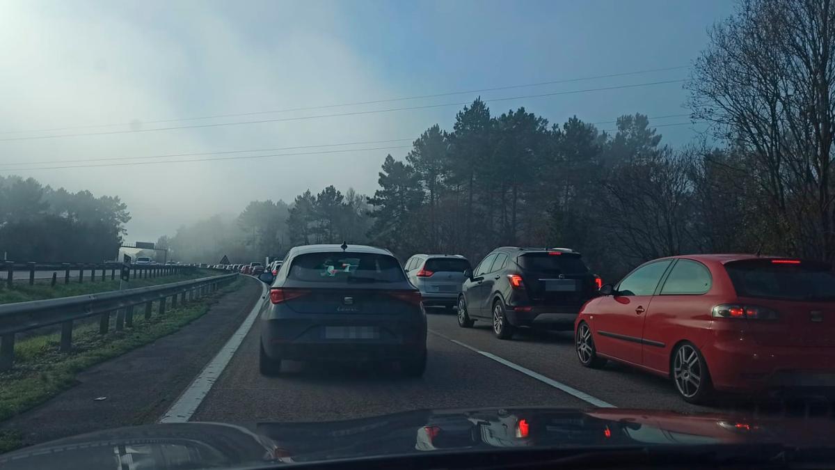 Retenciones en la "Y"