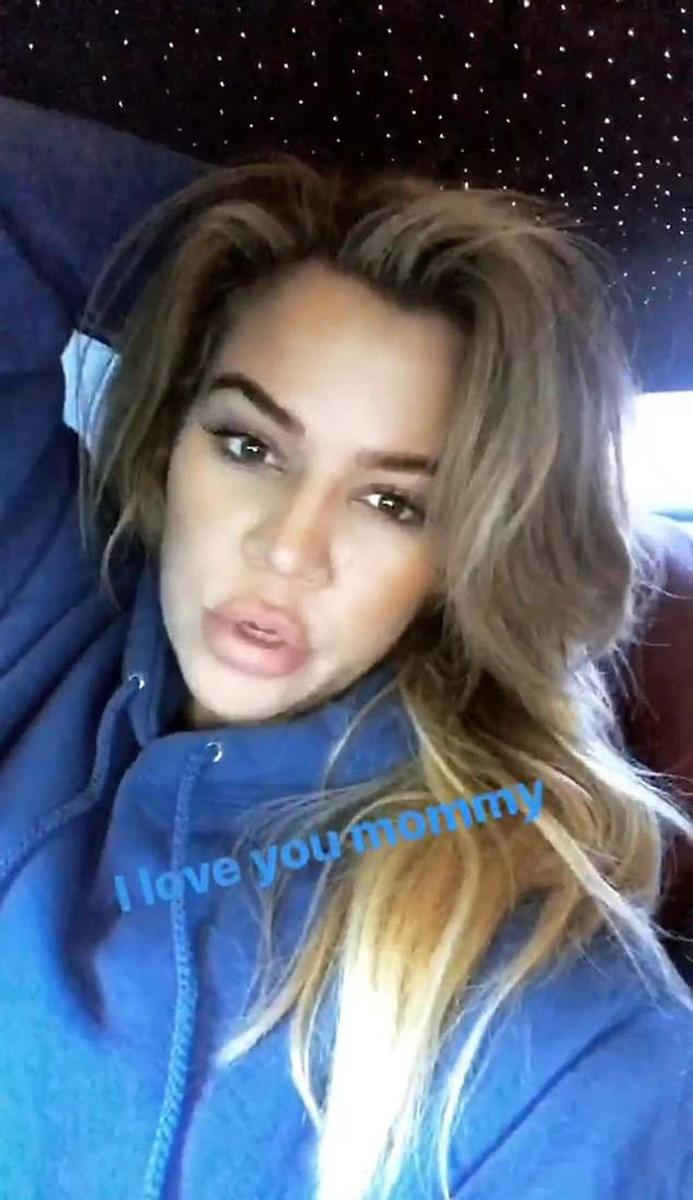 Khloe Kardashian con los labios visiblemente hinchados