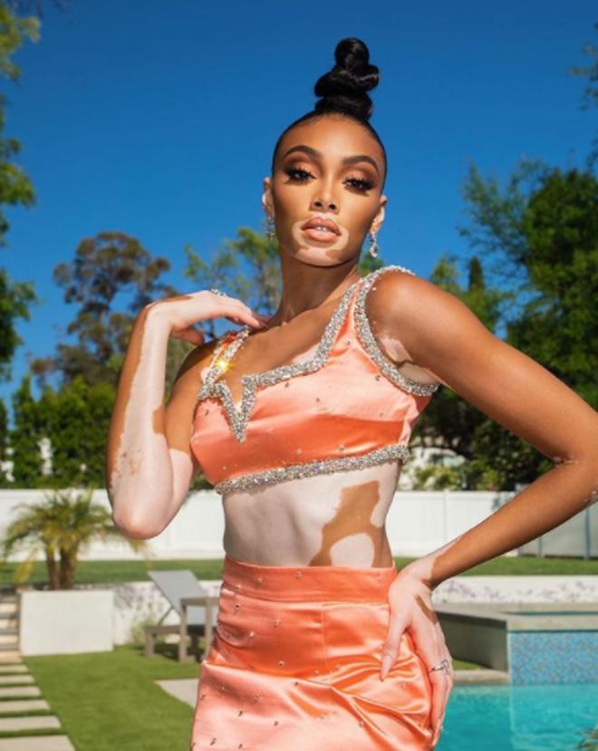 Winnie Harlow con dos piezas joya de Miu Miu y moño arquitectónico