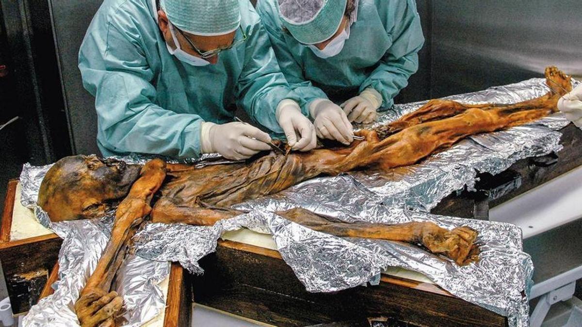 Els experts analitzant el cos d'Ötzi, l'home de gel