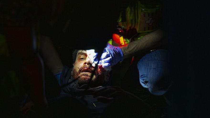 Pierde el ojo el joven herido en las cargas del aeropuerto de Barcelona