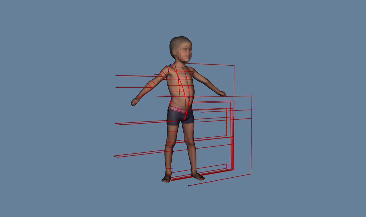 Niño escaneado contecnología de escaneadoMOVE4D, a la derecha, y ala izquierda, su avatar. IBV