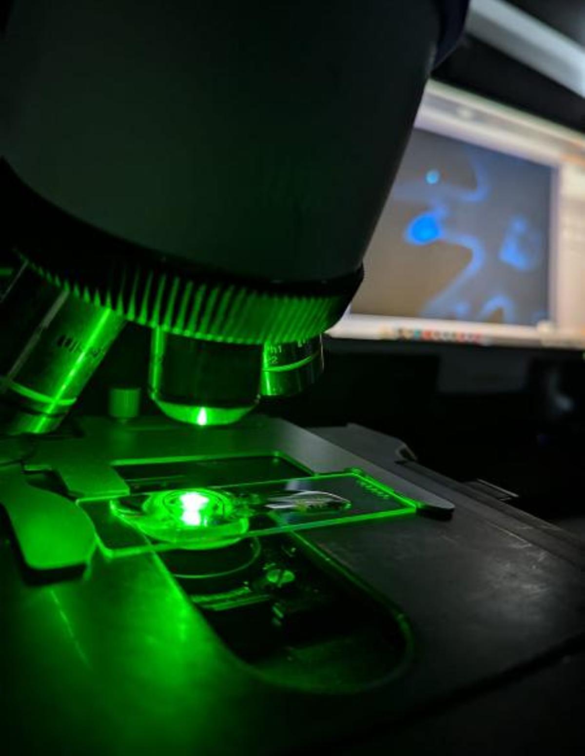 Microscopio de fluorescencia empleado para observar el daño celular en larvas de 'Aurelia aurita' tras el proceso de criopreservación.