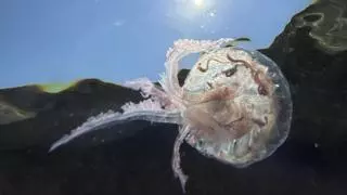 ¿Qué hacer si te pica una medusa?