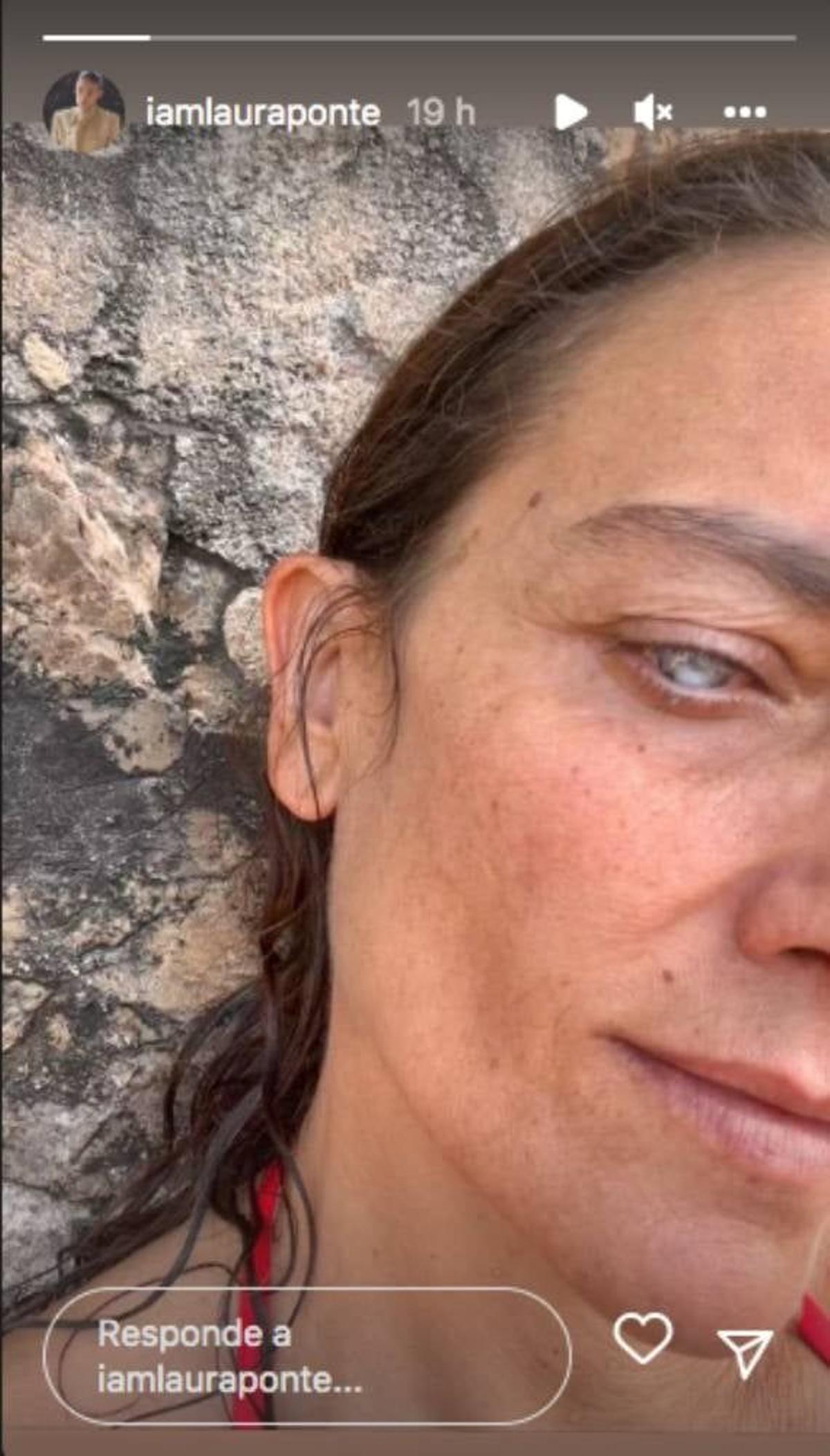 Laura Ponte enseña una foto en la que se ve cómo se encuentra su ojo