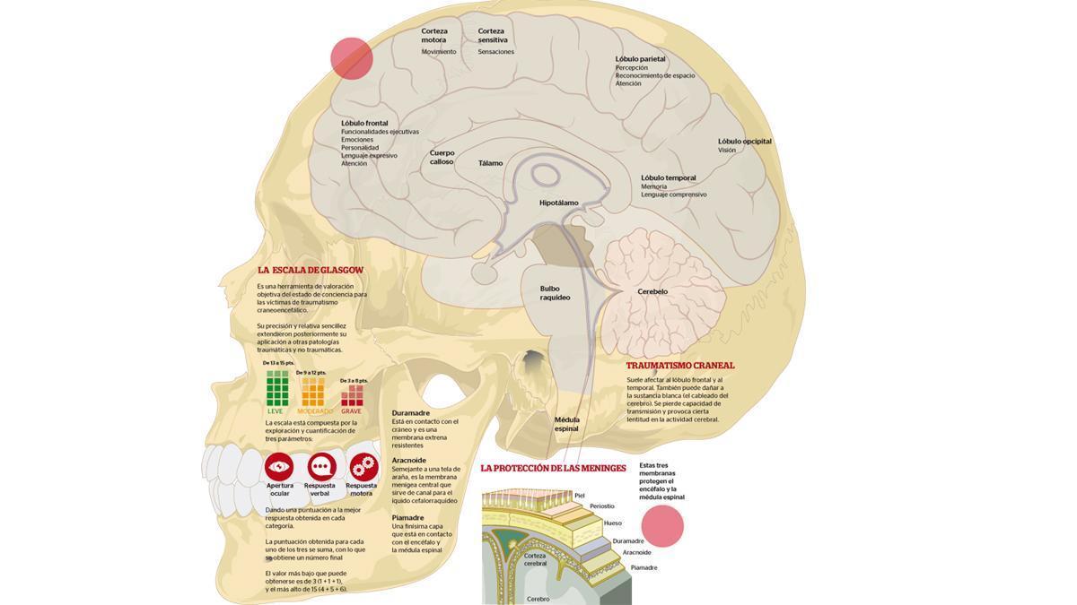 Las mejores 16 ideas de dilatacion