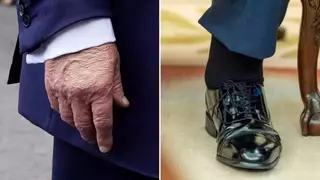 Trump se somete a un chequeo médico por hinchazón de piernas y cardenales en las manos