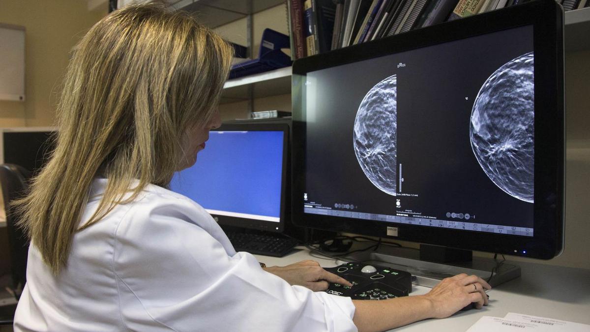 Una doctora analiza una mamografía.   | // MIGUEL ÁNGEL POLO